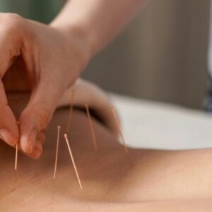 What Is Acupuncture? Benefits for Natural Pain Relief Today